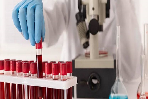 Services blood test